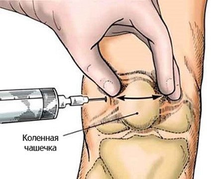 Ферматрон Плюс. Инструкция по применению, отзывы пациентов, цена