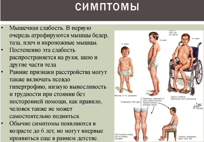 Мышцы бедра. Анатомия человека, расположение, функции передняя, задняя