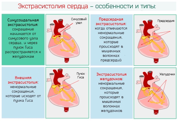 Схемы ритма для детей