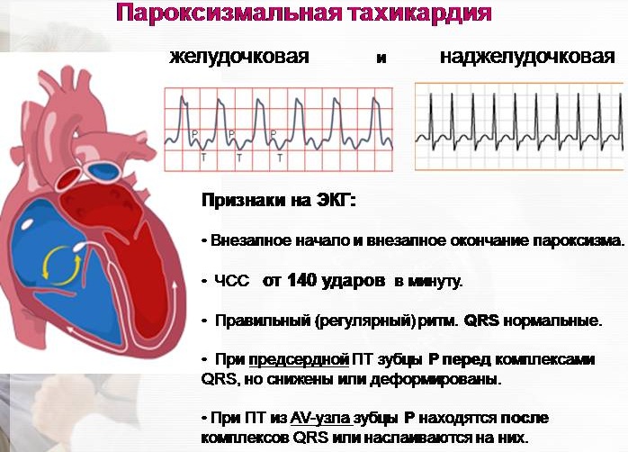 Схемы ритма для детей