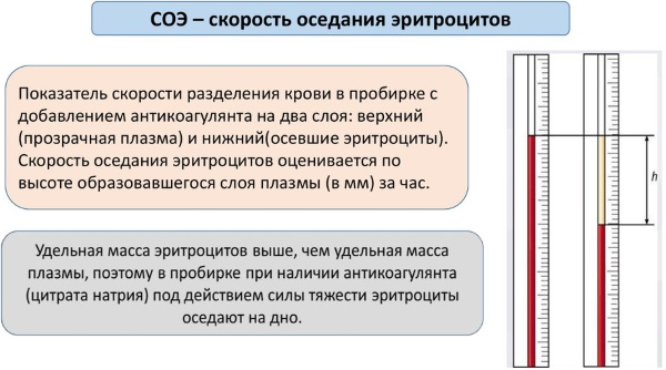 Оседание эритроцитов в крови. Норма по возрасту, при беременности, анализ из вены, пальца