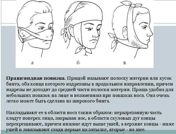Пращевидная повязка на нос. Алгоритм наложения, фото, видео