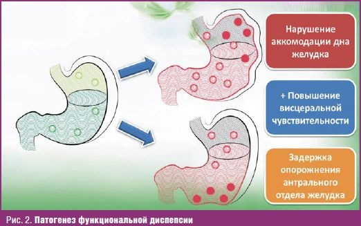 Проблемы с желудком. Симптомы, психосоматика, лечение, что можно кушать