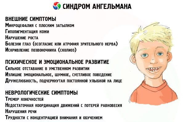 Синдром ангельмана картинки