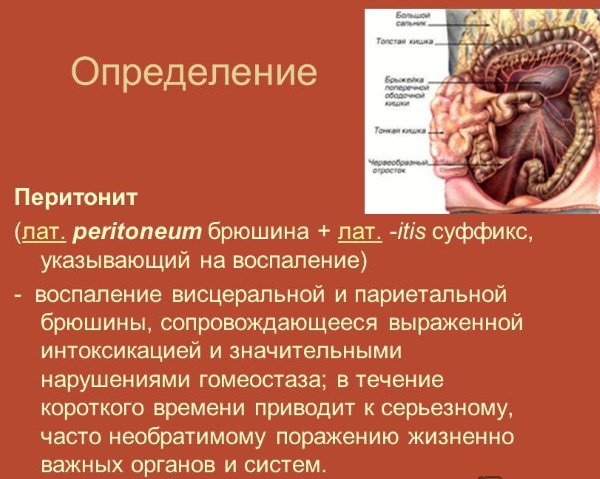 Синдром веста клинические рекомендации