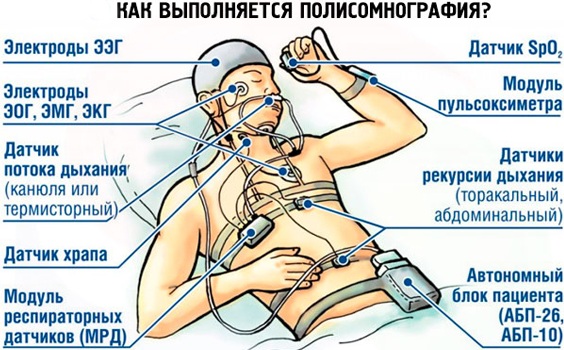 Сонный паралич. Что это такое, причины и лечение, как избежать