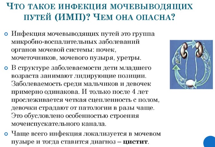 Воспаление мочевыводящих путей у женщин. Симптомы, лечение народными средствами, лекарства