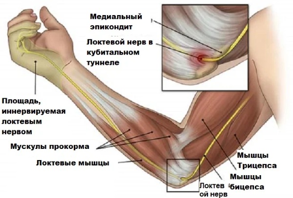 Болят локти рук. Причины и лечение