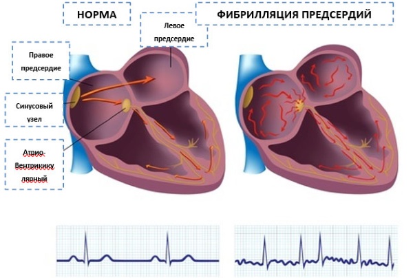 Бронхорасширяющие препараты. Таблетки для ингаляций взрослым