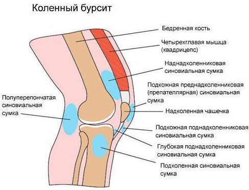 Гусиная лапка коленного сустава. Что это такое, анатомия, лечение