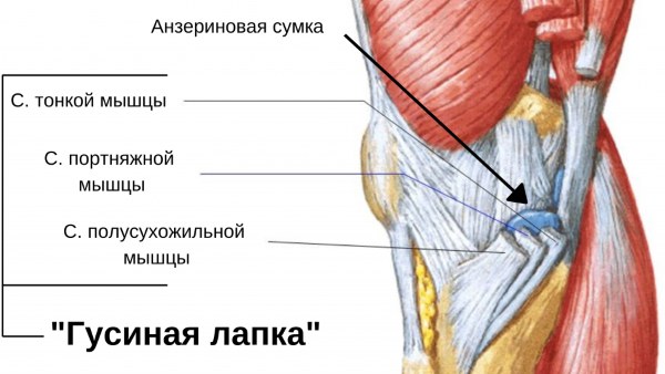 Гусиная лапка коленного сустава. Что это такое, анатомия, лечение