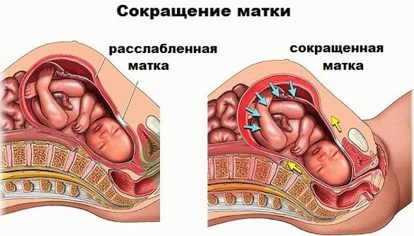 Колит справа внизу живота у женщин возле кости таза. Причины