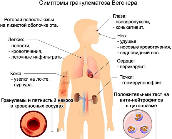 Кровеносные сосуды человека. Схема системы кровообращения, анатомия