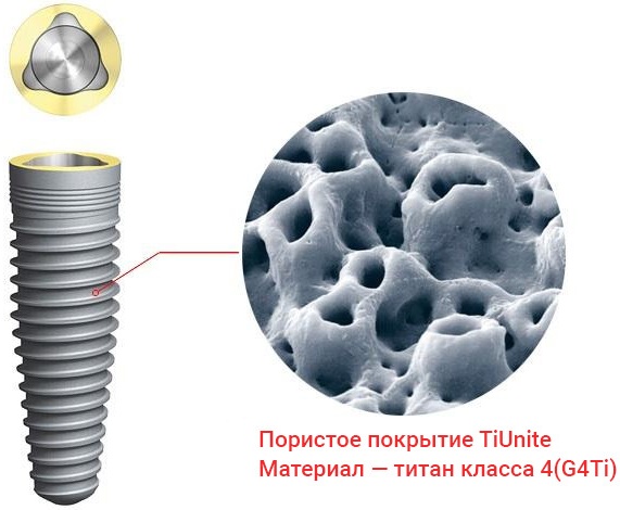 Импланты Nobel Biocare. Производитель, цена под ключ, отзывы