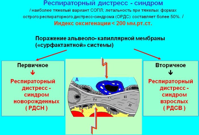 Респираторный дистресс-синдром (РДС) у взрослых, новорожденных, этиология, патогенез, клинические рекомендации