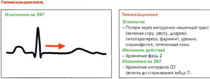 Симптом Хвостека и Труссо. Что это такое у взрослых, детей