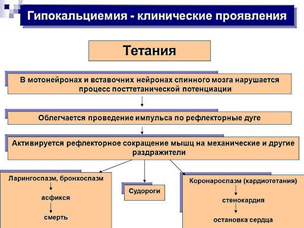 Симптом Хвостека и Труссо. Что это такое у взрослых, детей