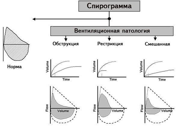 Спирография. Подготовка пациента к исследованию взрослого, детей