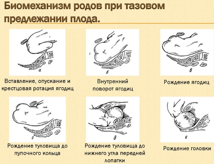 Поперечное положение плода в 34 недели фото