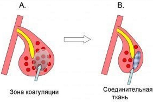 Зависимость от капель для носа. Как избавиться, как называется, лечение