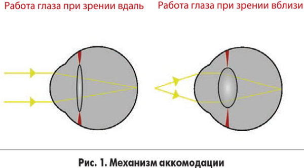 Аккомодация глаза в офтальмологии. Что это такое