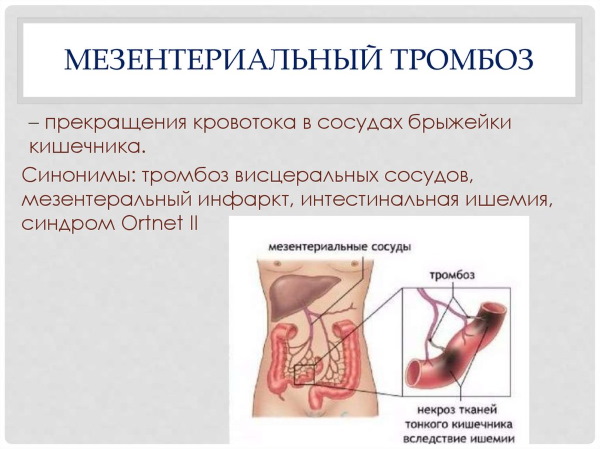 Аорта у человека. Где находится, начинается, отходит, анатомия