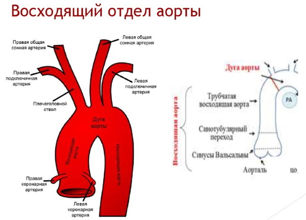 Где Находится Аорта У Человека Фото