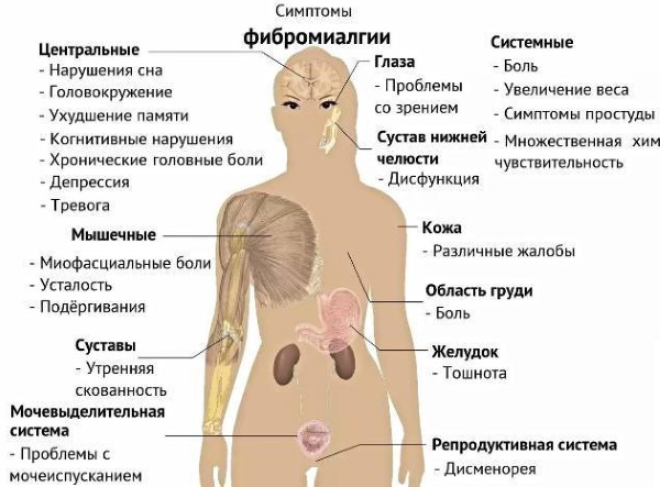 Боли в мышцах ног и рук. Причины и лечение, медикаменты