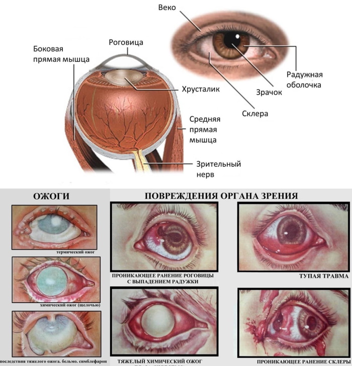 Болит глаз, как будто давит изнутри, видит хуже, больно закрывать, открывать. Лечение