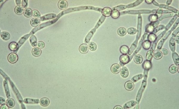 Кандида альбиканс (Candida albicans). Что это такое, норма, лечение
