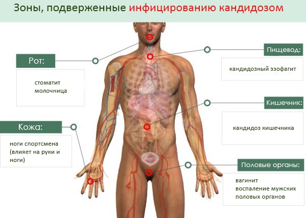 Кандида альбиканс (Candida albicans). Что это такое, норма, лечение