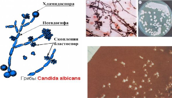 Кандида альбиканс (Candida albicans). Что это такое, норма, лечение