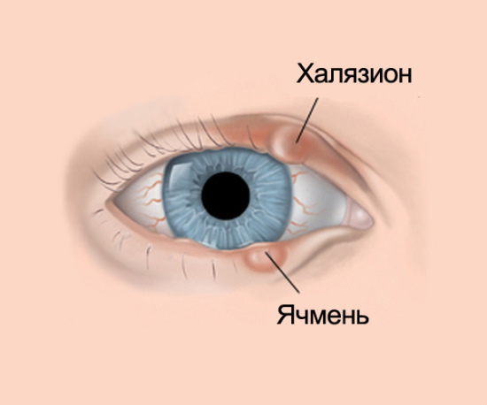 ДексаТобропт глазные капли. Инструкция по применению, цена, отзывы