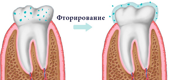 Гигиеническая чистка зубов профессиональная. Отзывы, цены