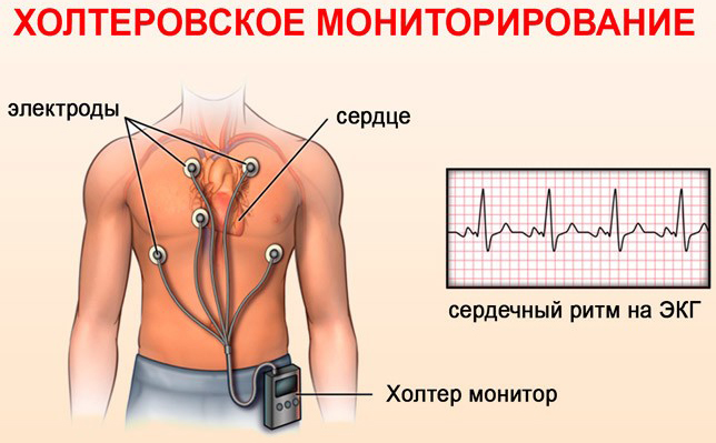 Холтеровское (суточное) мониторирование сердца ЭКГ. Цены