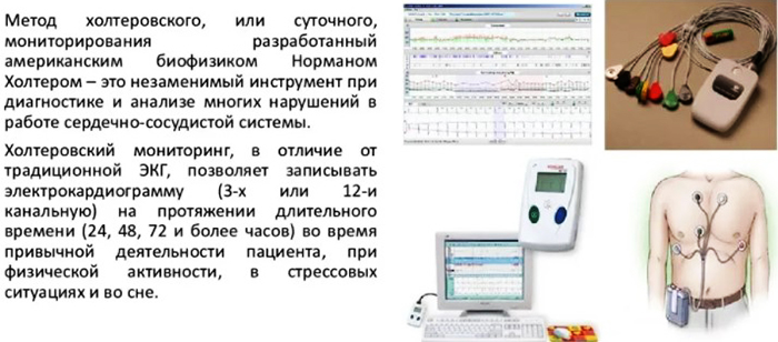 Холтеровское (суточное) мониторирование сердца ЭКГ. Цены