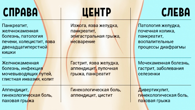 Колит внизу живота слева у женщин, мужчин, при беременности. Причины