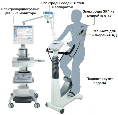 Ортостатическая проба и методика ее выполнения спортсменам, детям, пожилым