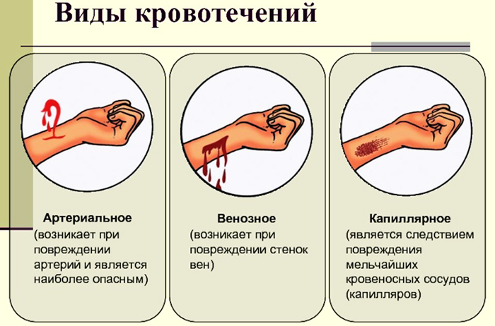 Фото пальцевое прижатие артерии