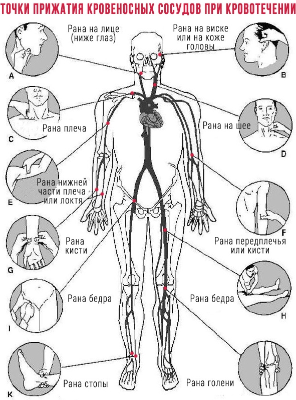 Пальцевое прижатие бедренной артерии. Где, как выполняется, алгоритм
