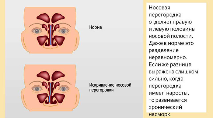 Переносица носа где находится фото у человека