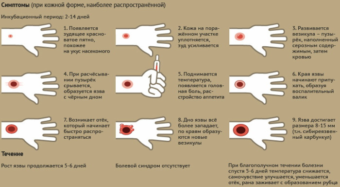 Природно-очаговые заболевания. Что это такое, примеры, список, причины