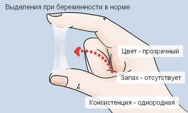 Слизистые выделения при беременности: желтые, белые, коричневые, зеленые