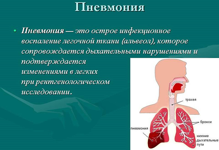 Сульфадимезин. Показания к применению, инструкция, цена, отзывы