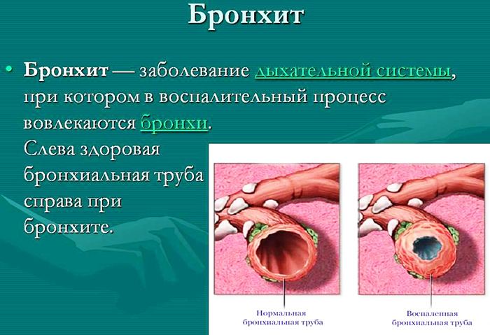 Сульфадимезин. Инструкция по применению, показания, цена