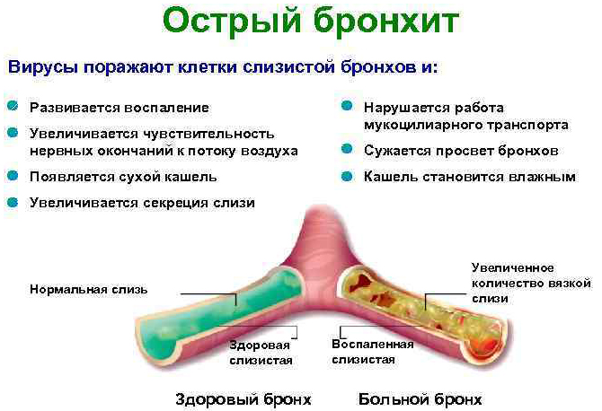 УВЧ-терапия. Что это такое, показания и противопоказания