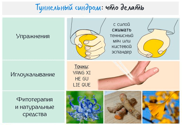 Запястье руки. Анатомия, где находится, как болит, причины, лечение