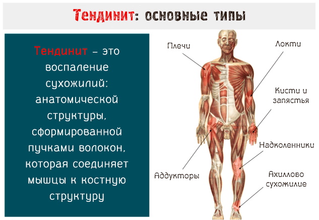 Где находится запястье фото