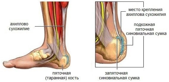 Ахиллово (ахиллесово) сухожилие. Где находится на ноге, фото, анатомия