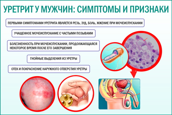 Аналоги Канефрона в таблетках при беременности, лактации. Цена